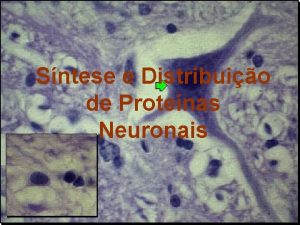 Sntese e Distribuio de Protenas Neuronais O Neurnio