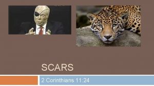 SCARS 2 Corinthians 11 24 Scars Talk 2