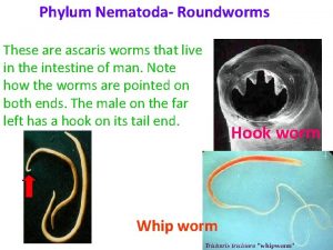 Phylum Nematoda Roundworms These are ascaris worms that