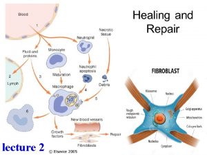 Healing and repair lecture 2 Wound healing Healing
