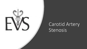 Carotid Artery Stenosis Nature of the Problem Approximately