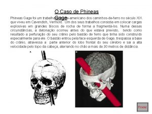 O Caso de Phineas Gage foi um trabalhador