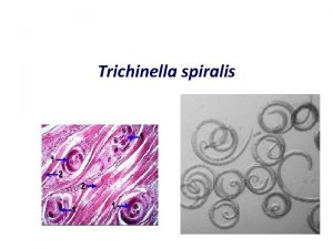 Trichinella spiralis SALIENT FEATURES v COMMON NAME Trichina