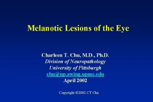 Melanotic Lesions of the Eye Charleen T Chu