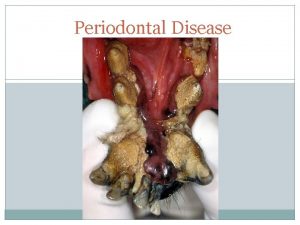 Periodontal Disease Normal Periodontium Remember which structures make