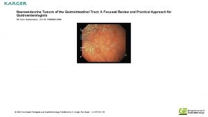 Neuroendocrine Tumors of the Gastrointestinal Tract A Focused