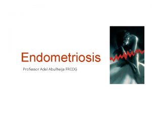 Endometriosis Professor Adel Abulheija FRCOG Endometriosis Presence of