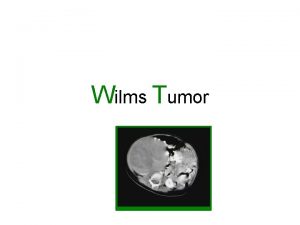 Wilms Tumor Wilms tumor or nephroblastoma is malignant