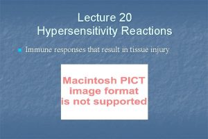 Lecture 20 Hypersensitivity Reactions n Immune responses that