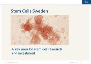 Stem Cells Sweden A key area for stem