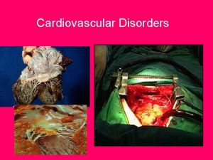 Cardiovascular Disorders Hypertension p 671 Ateriosclerosis silent killer