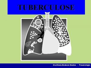 TUBERCULOSE Dra Eliane Bodevan Bastos Pneumologia UMA REFLEXO