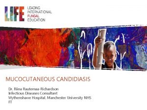 MUCOCUTANEOUS CANDIDIASIS Dr Riina RautemaaRichardson Infectious Diseases Consultant