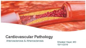 Cardiovascular Pathology Arteriosclerosis Atherosclerosis Ghadeer Hayel MD 10112019