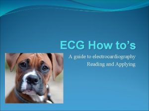 ECG How tos A guide to electrocardiography Reading