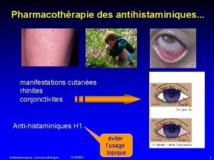 Pharmacothrapie des antihistaminiques manifestations cutanes rhinites conjonctivites Antihistaminiques