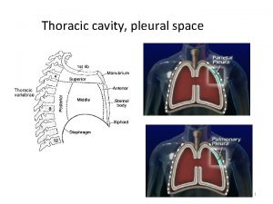 Thoracic cavity pleural space 1 Conditions requiring chest