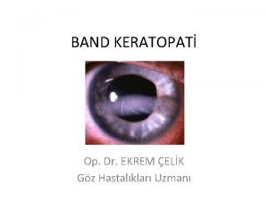 BAND KERATOPAT Op Dr EKREM ELK Gz Hastalklar