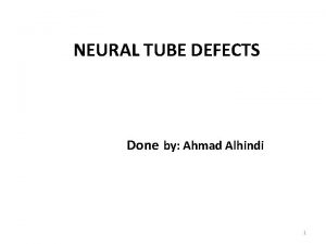 NEURAL TUBE DEFECTS Done by Ahmad Alhindi 1