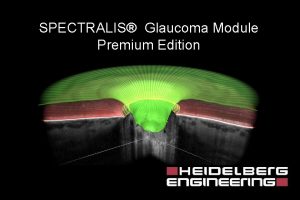 SPECTRALIS Glaucoma Module Premium Edition Clinical Mismatch between