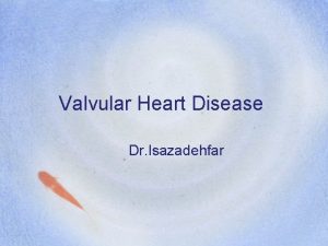 Valvular Heart Disease Dr Isazadehfar Types Mitral Stenosis