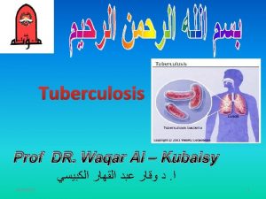 Tuberculosis Prof DR Waqar Al Kubaisy 1062019 1