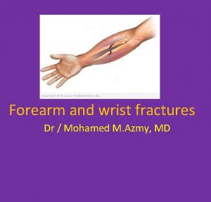 Forearm and wrist fractures Dr Mohamed M Azmy