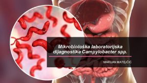 Mikrobioloka laboratorijska dijagnostika Campylobacter spp MARIJAN MATEJI UVOD