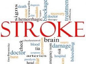 So what is a stroke AKA cerebrovascular accident