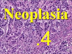 Neoplasia 4 3 rd year 30520 Neoplasia 4
