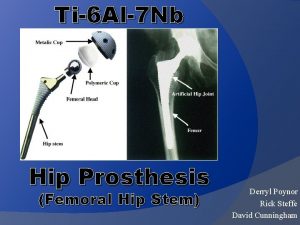 Ti6 Al7 Nb Hip Prosthesis Femoral Hip Stem