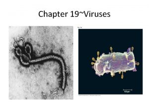 Chapter 19Viruses Viral structure Virus poison Latin infectious