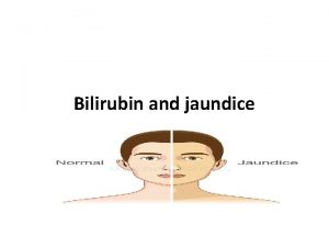 Bilirubin and jaundice Bilirubin is the substance that