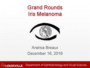 Grand Rounds Iris Melanoma Andrea Breaux December 16