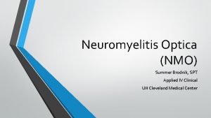 Neuromyelitis Optica NMO Summer Brodnik SPT Applied IV