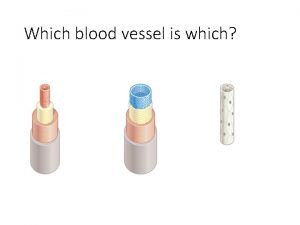 Which blood vessel is which Learning Objectives What