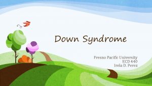Down Syndrome Fresno Pacific University ECD 440 Irela