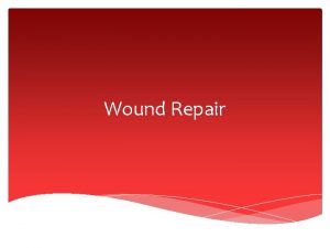 Wound Repair Kinds of Wounds A wound occurs