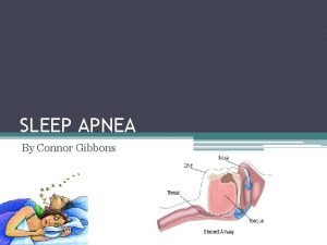 SLEEP APNEA By Connor Gibbons What is Sleep