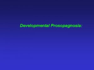 Developmental Prosopagnosia Developmental prosopagnosia Face recognition impairment without