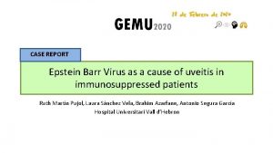 CASE REPORT Epstein Barr Virus as a cause