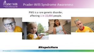 PraderWilli Syndrome Awareness PWS is a rare genetic