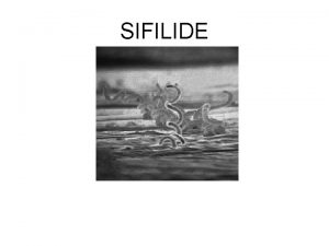 SIFILIDE Sifilide La sifilide conosciuta anche come lue