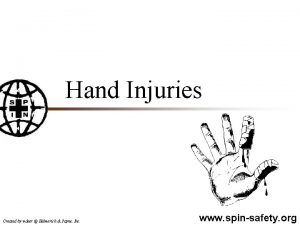 Hand Injuries Created by wdeer Helmerich Payne Inc