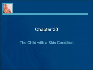 Chapter 30 The Child with a Skin Condition