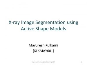 Xray Image Segmentation using Active Shape Models Mayuresh