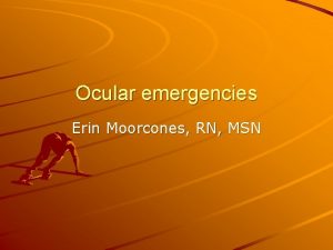 Ocular emergencies Erin Moorcones RN MSN The Eye