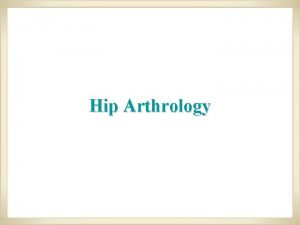 Hip Arthrology The acetabulum is located at the