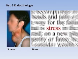 Hst 3 Endocrinologie Struma Stress 3 1 Hormonen