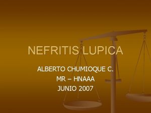 NEFRITIS LUPICA ALBERTO CHUMIOQUE C MR HNAAA JUNIO